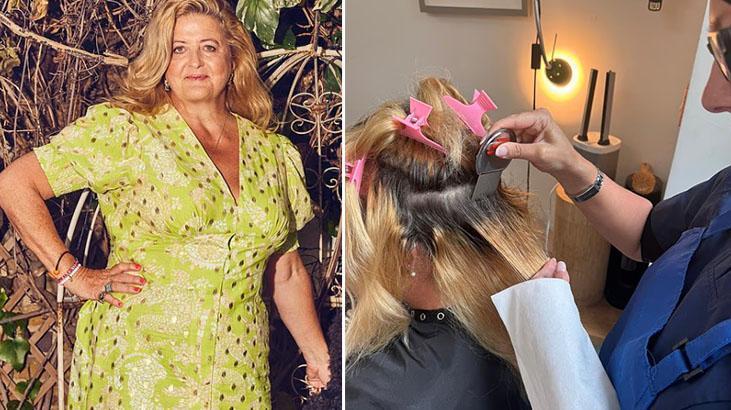 56 yaşında hayatının şokunu yaşadı! Kafasındaki kaşıntı bit değilmiş