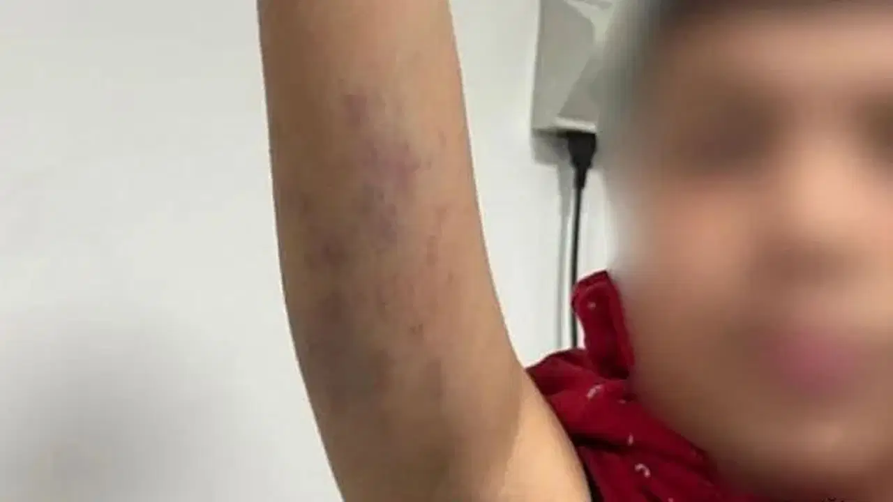 Otizmli öğrenciye darp iddiası: İstanbul İl Milli Eğitim Müdürlüğü açıklama yaptı