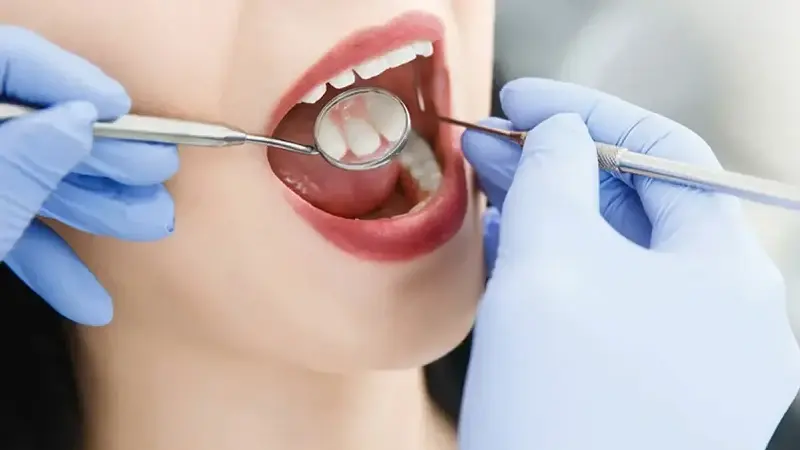 Uzmanı uyardı: Diş travmalarında ilk 30 dakika kritik önem taşıyor